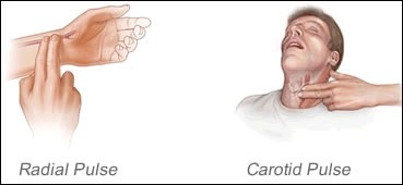 Carotid Pulse