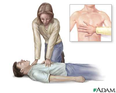 How to Perform Chest Compressions on a Child - First Aid for Free