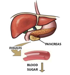 Diabetic Ketoacidosis