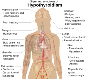 Hypothyroidism