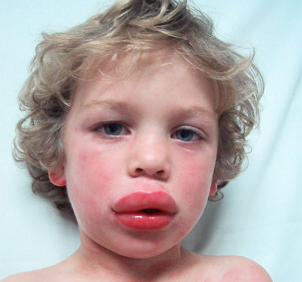 Signs and symptoms first aid for free