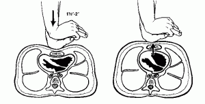 How deep should you compress the chest during chest compressions? - First  Aid for Free