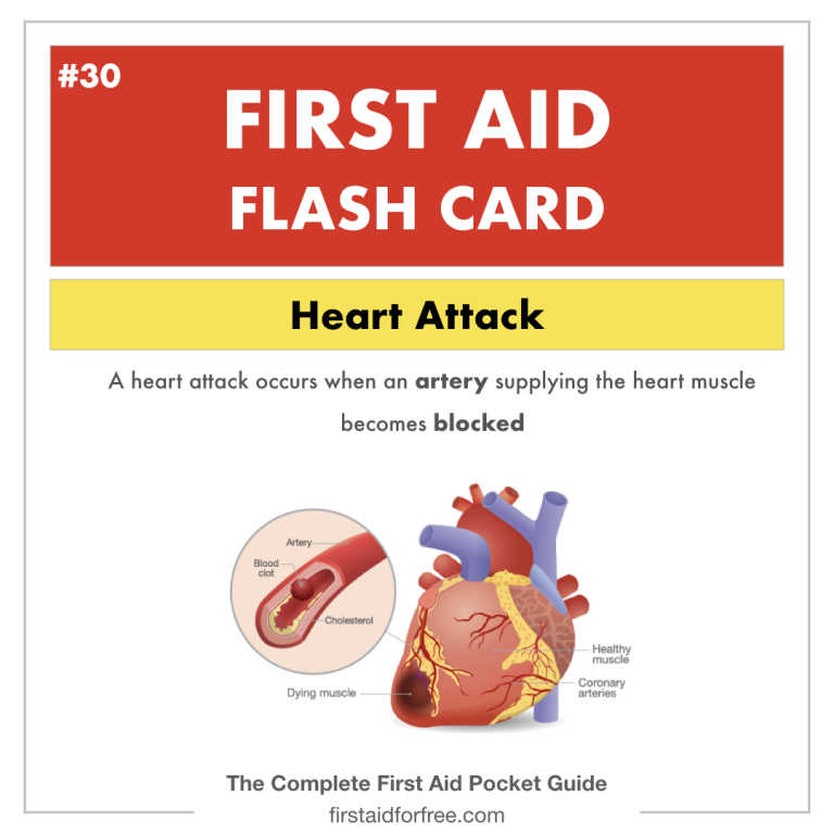 First Aid Flashcard 30 Heart Attack Diagram First Aid for Free