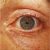 pinpoint pupils diabetes pinpoint pupils diabetes