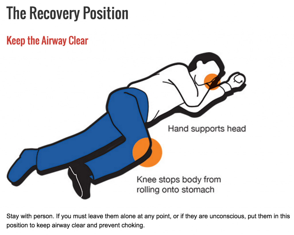 Different Types of Recovery Position