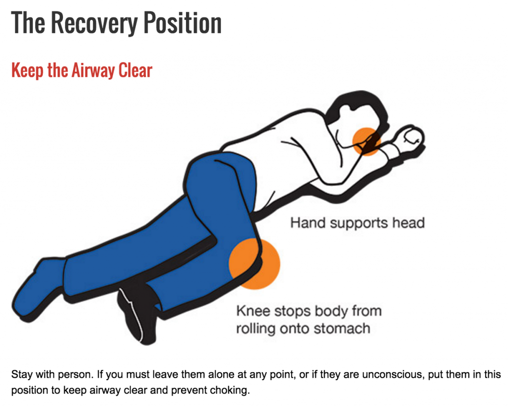 Recovery Position For Spinal Injury