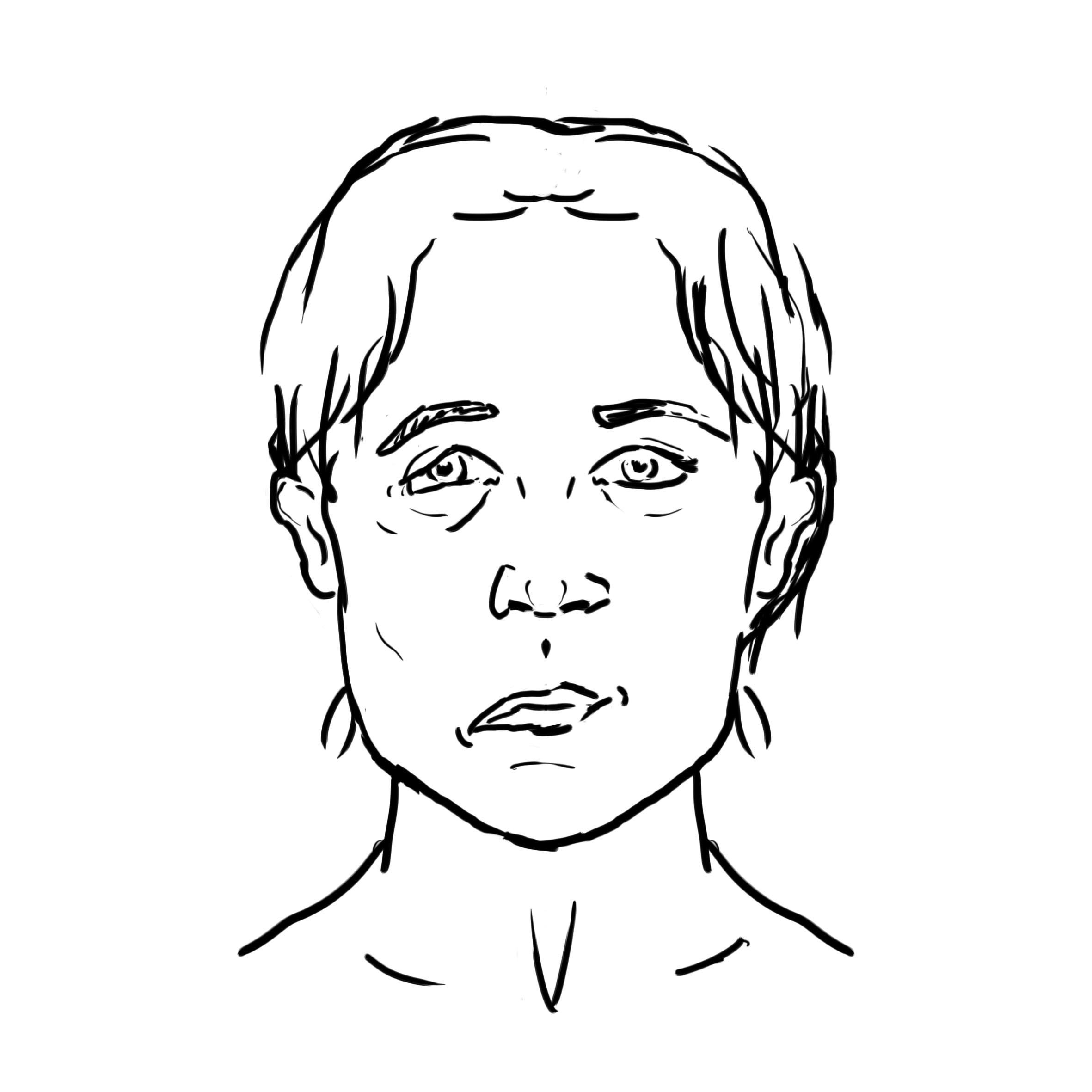 Facial Droop, Slurred Speech?  Urgent Stroke Check - ai7ktyi
