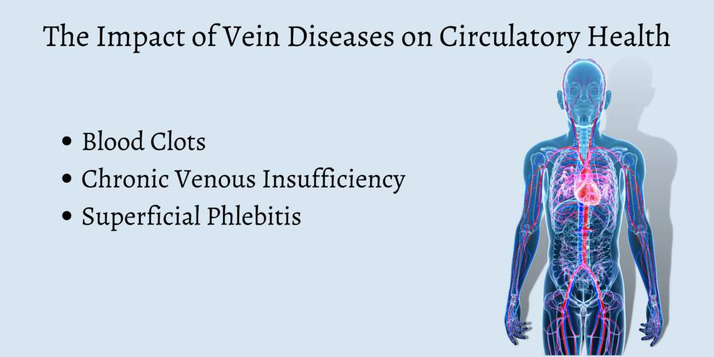 The Impact of Vein Diseases on Circulatory Health