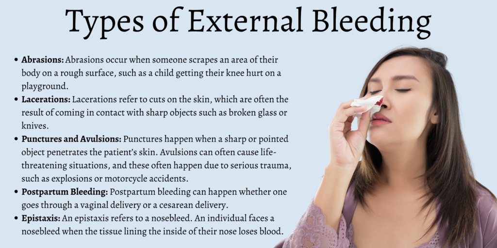 Types of External Bleeding