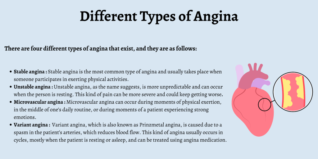 Different Types of Angina