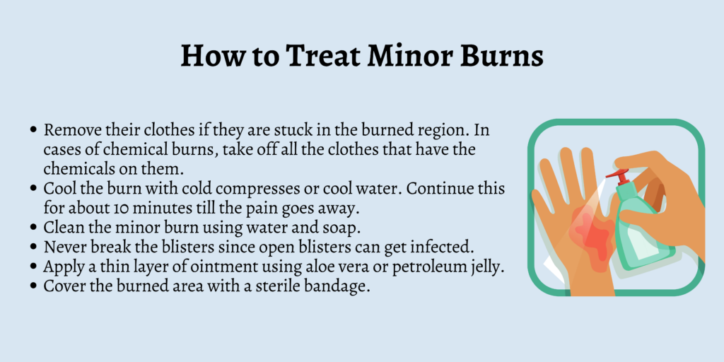 How to Treat Minor Burns