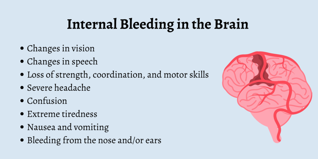 Internal bleeding