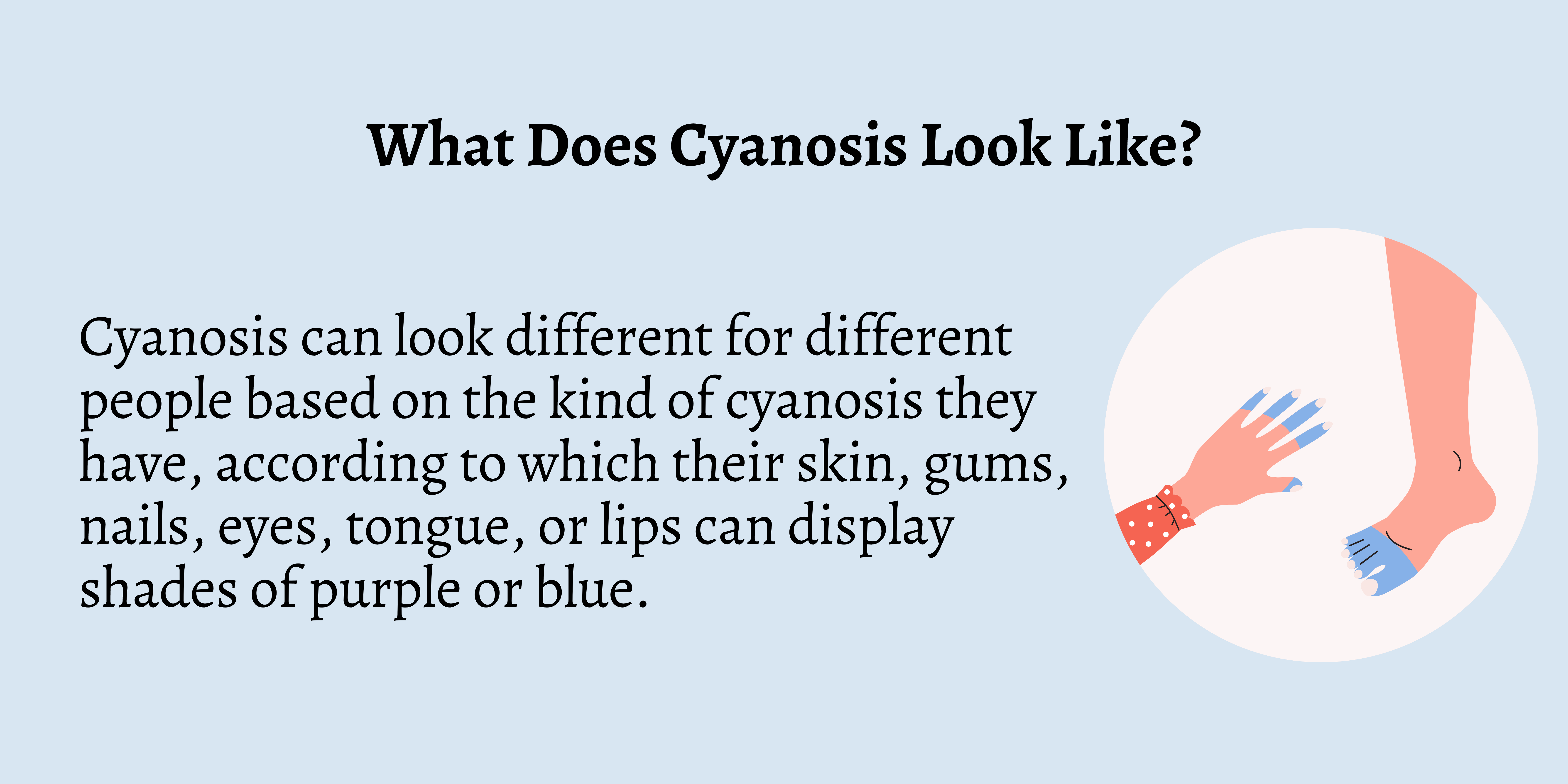 what is cyanosis means