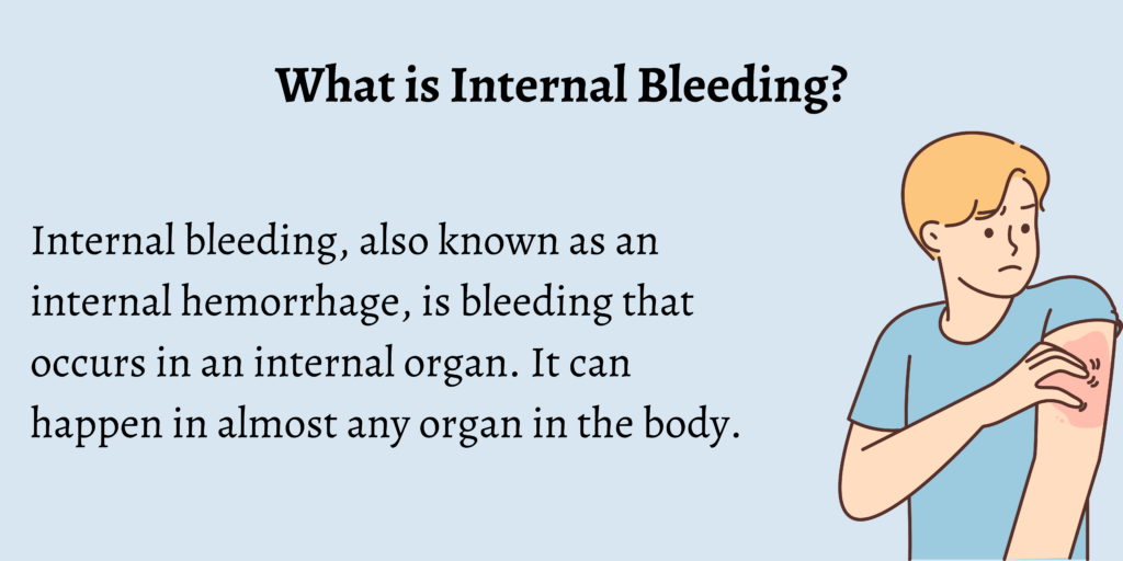 What is Internal Bleeding