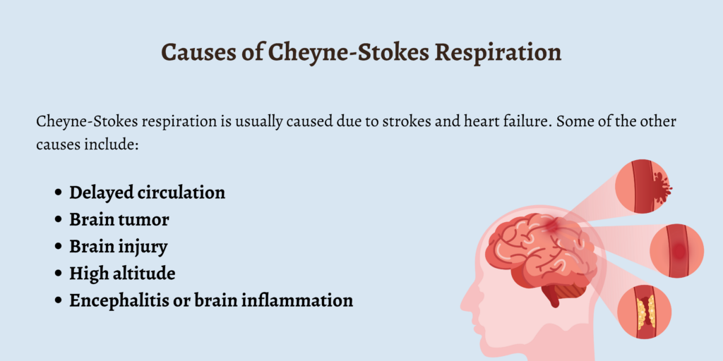 Causes of Cheyne-Stokes Respiration