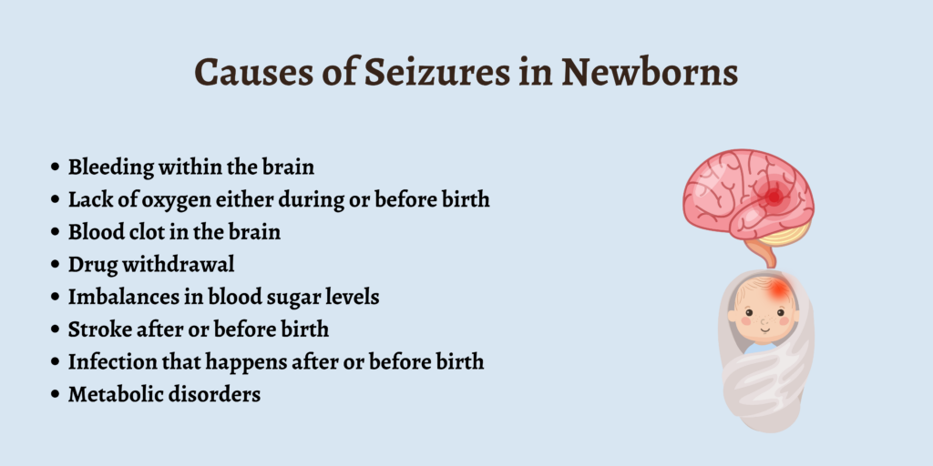 Causes of Seizures in Newborns