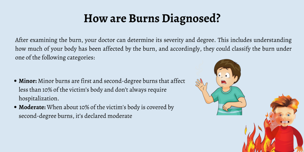 How are Burns Diagnosed