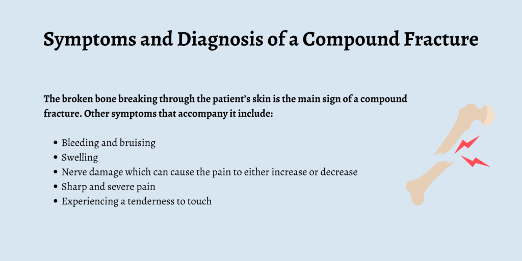 Symptoms and Diagnosis of a Compound Fracture