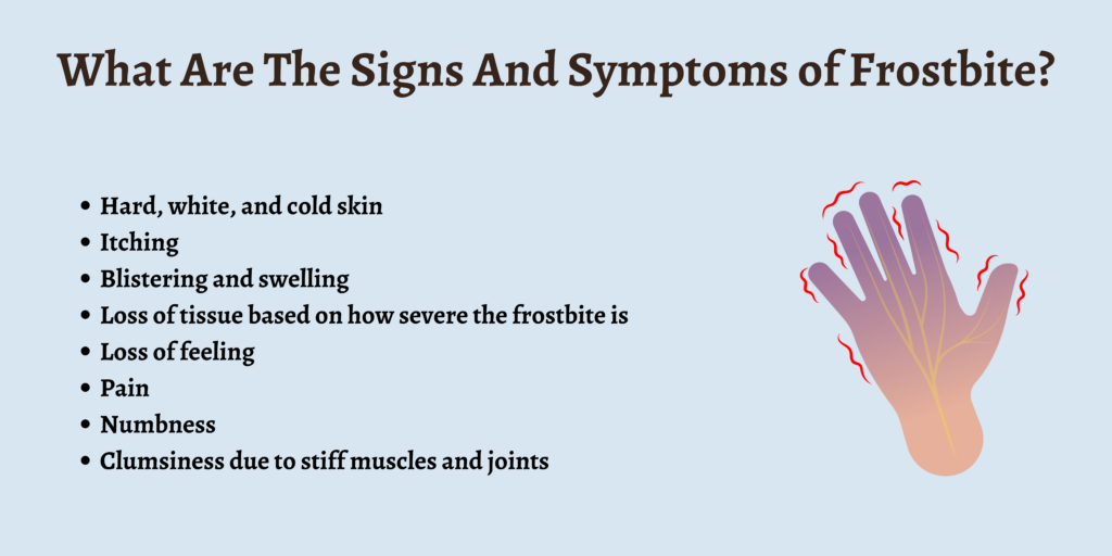 What Are The Signs And Symptoms of Frostbite