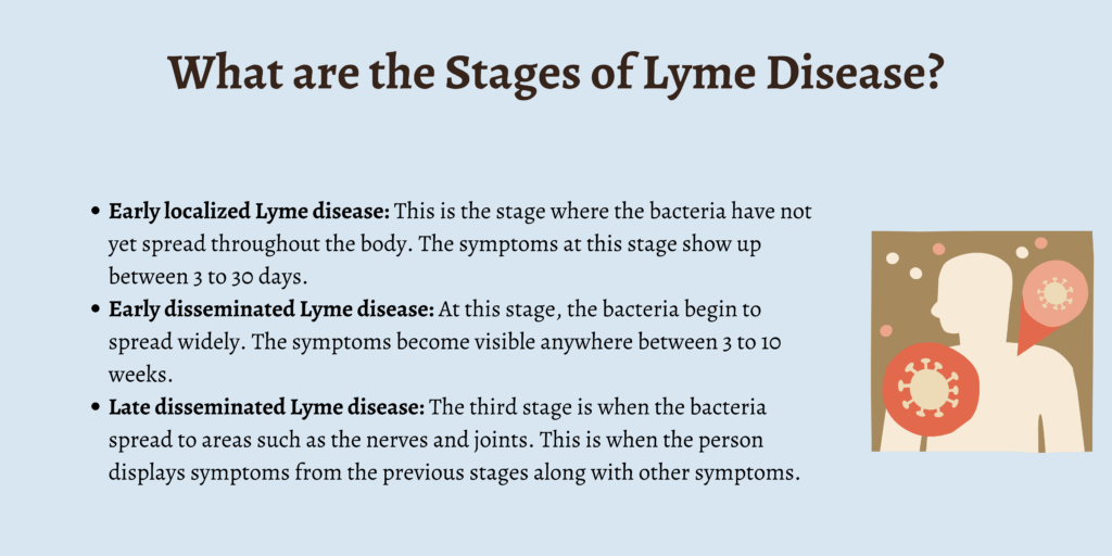 What are the Stages of Lyme Disease