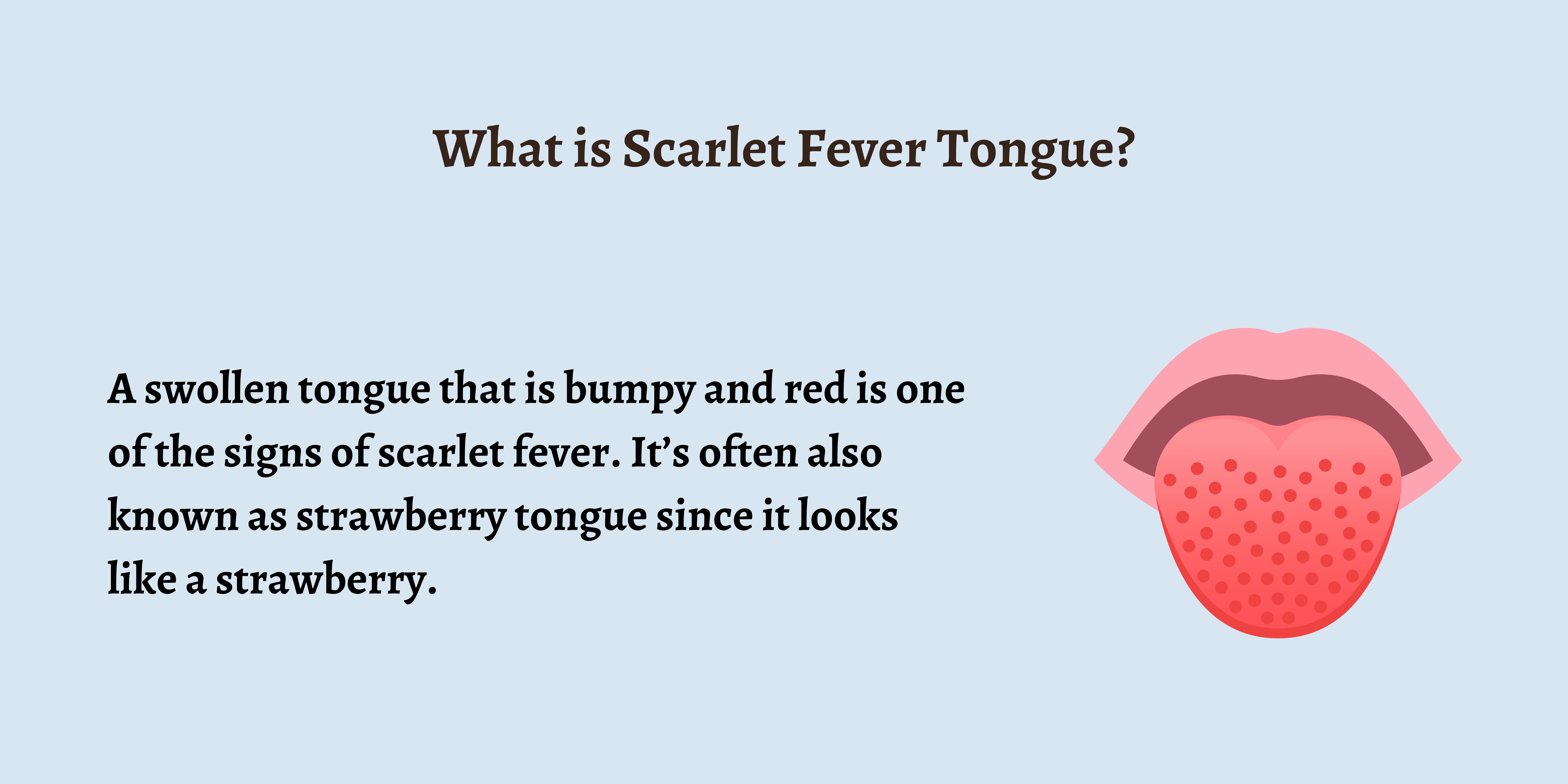 Scarlet Fever: What it Looks Like and What Causes it