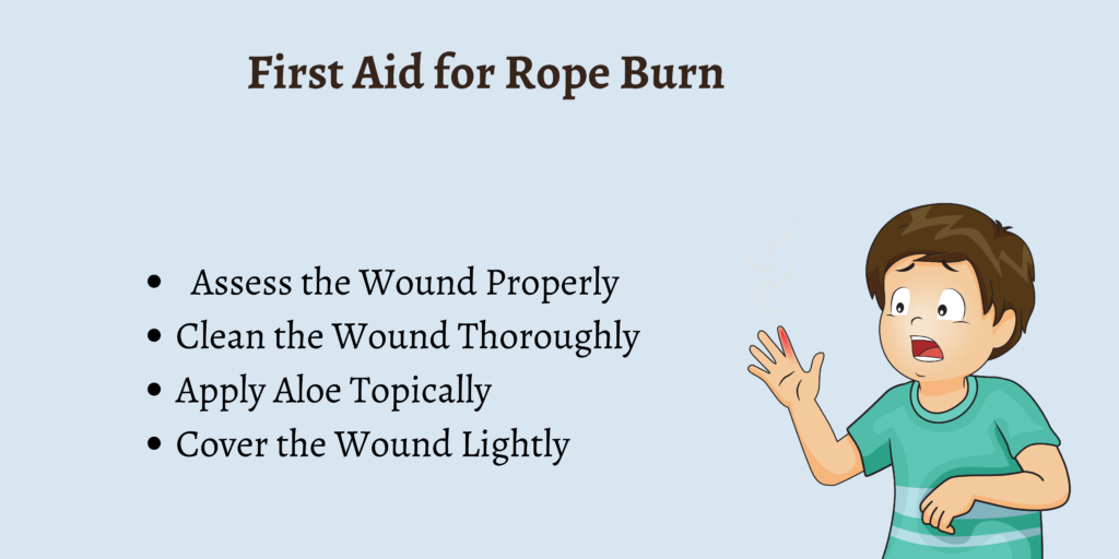 First Aid for Rope Burn